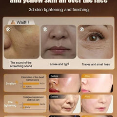 Anti-Wrinkle Forehead (Pack of 2) 100ml Each